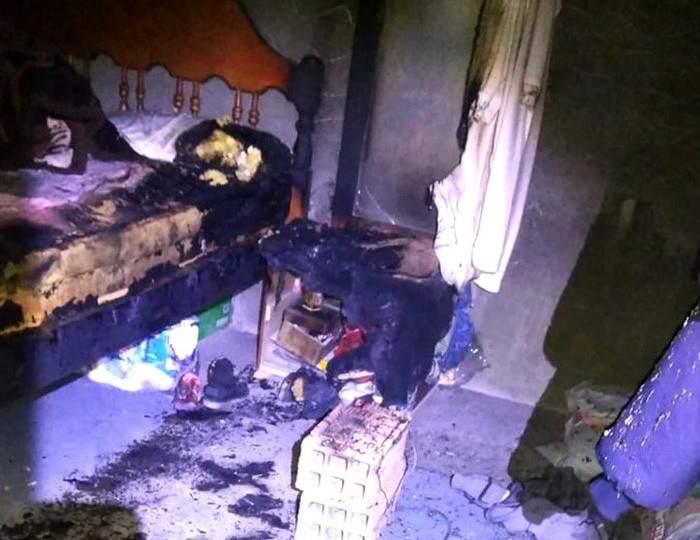 EVOLUCIONA LA SALUD DE LOS NIÑOS AFECTADOS POR EL INCENDIO DE SU VIVIENDA