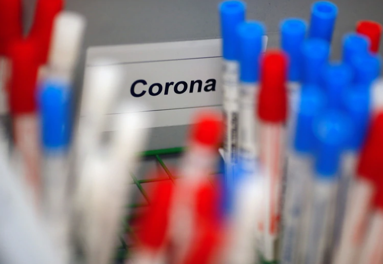 CIENTÍFICOS IDENTIFICAN UN FÁRMACO QUE BLOQUEA AL CORONAVIRUS CUANDO BUSCA INFECTAR NUEVAS CÉLULAS