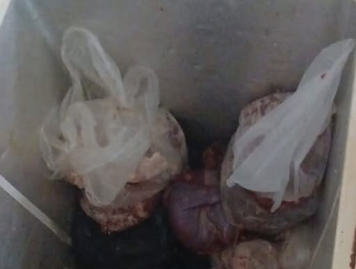 Le diagnosticaron Síndrome Urémico Hemolítico tras consumir carne comprada en Facebook